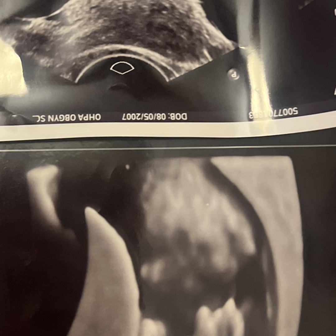 Photo shared by Emily for their Babylist baby registry.