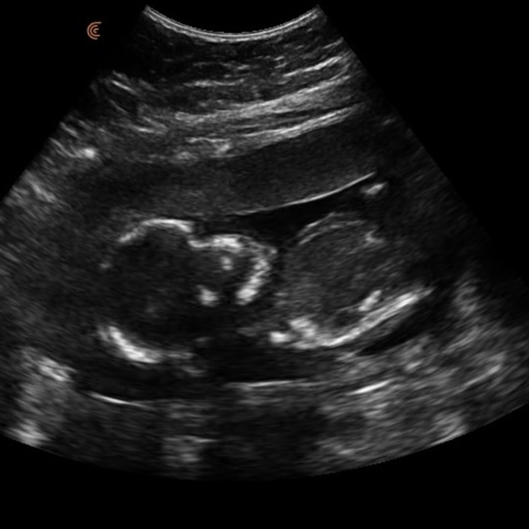 Photo shared by Erika for their Babylist baby registry.