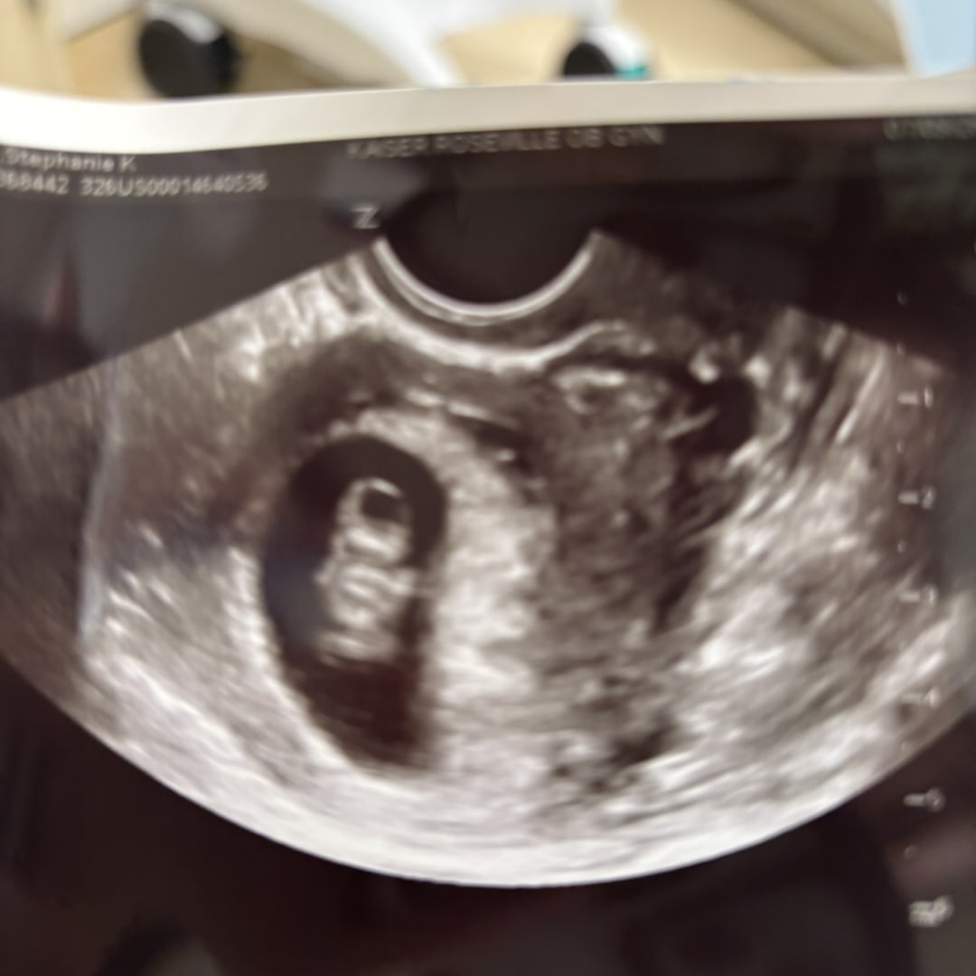 Photo shared by Stephanie for their Babylist baby registry.