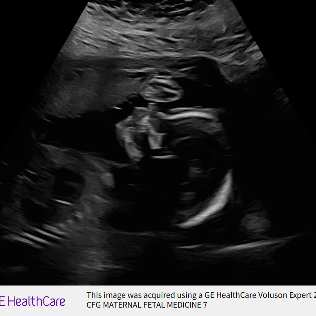 Photo shared by Shaina for their Babylist baby registry.