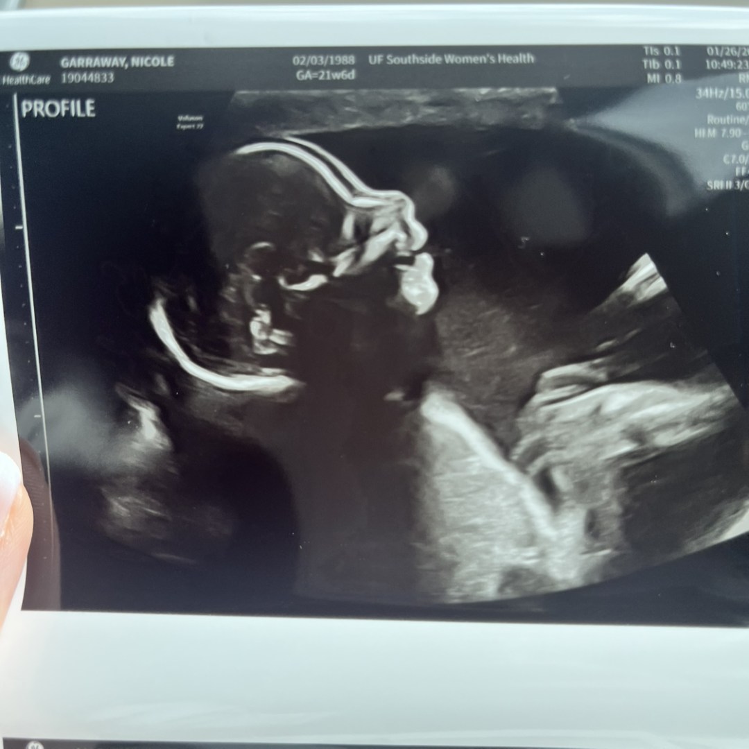 Photo shared by Nicole for their Babylist baby registry.