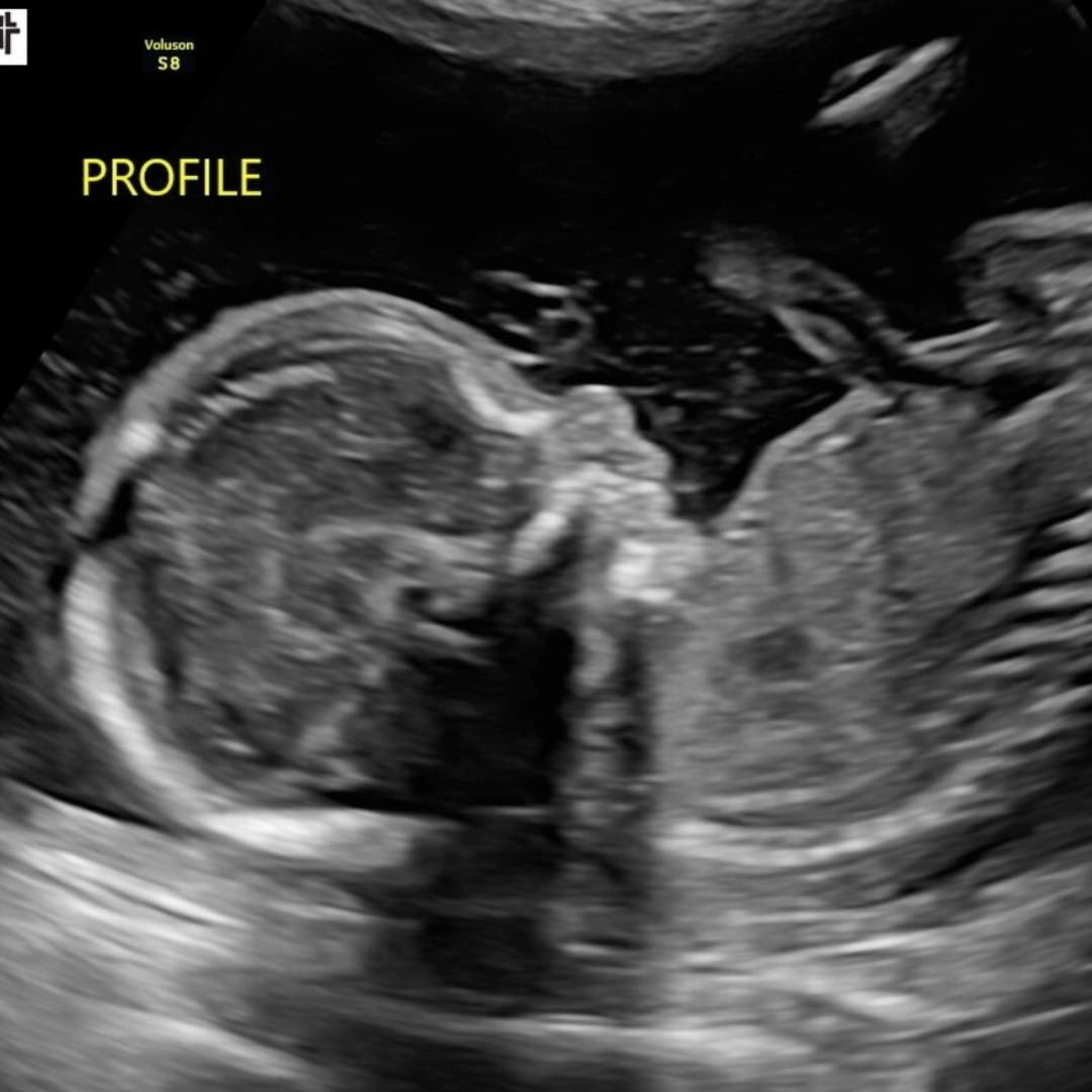 Photo shared by Crystal for their Babylist baby registry.