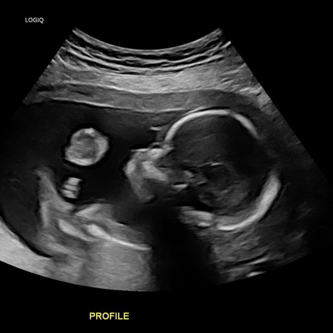 Photo shared by Samantha for their Babylist baby registry.