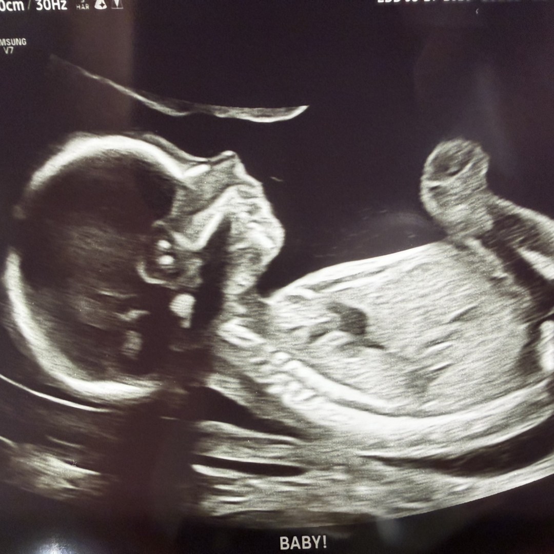 Photo shared by Melissa for their Babylist baby registry.