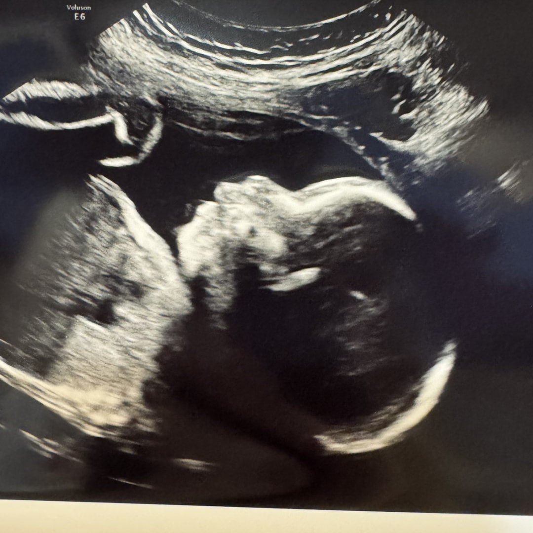 Photo shared by Julianne for their Babylist baby registry.