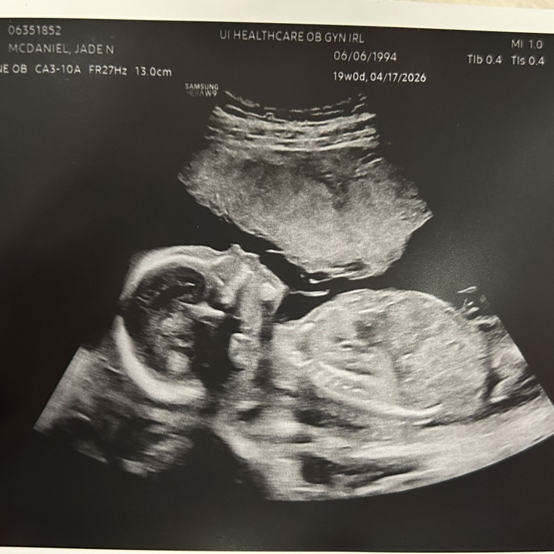 Photo shared by Jade for their Babylist baby registry.