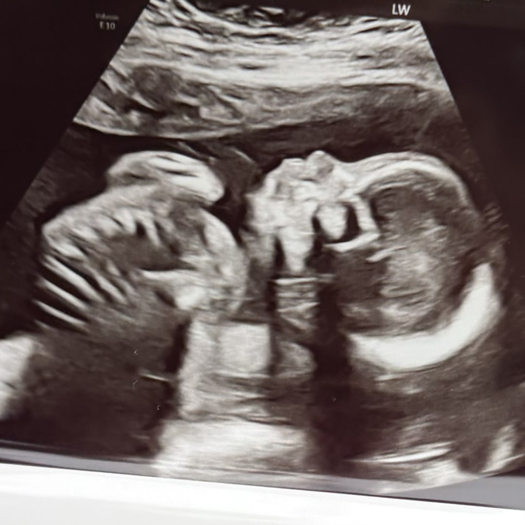 Photo shared by Gina for their Babylist baby registry.