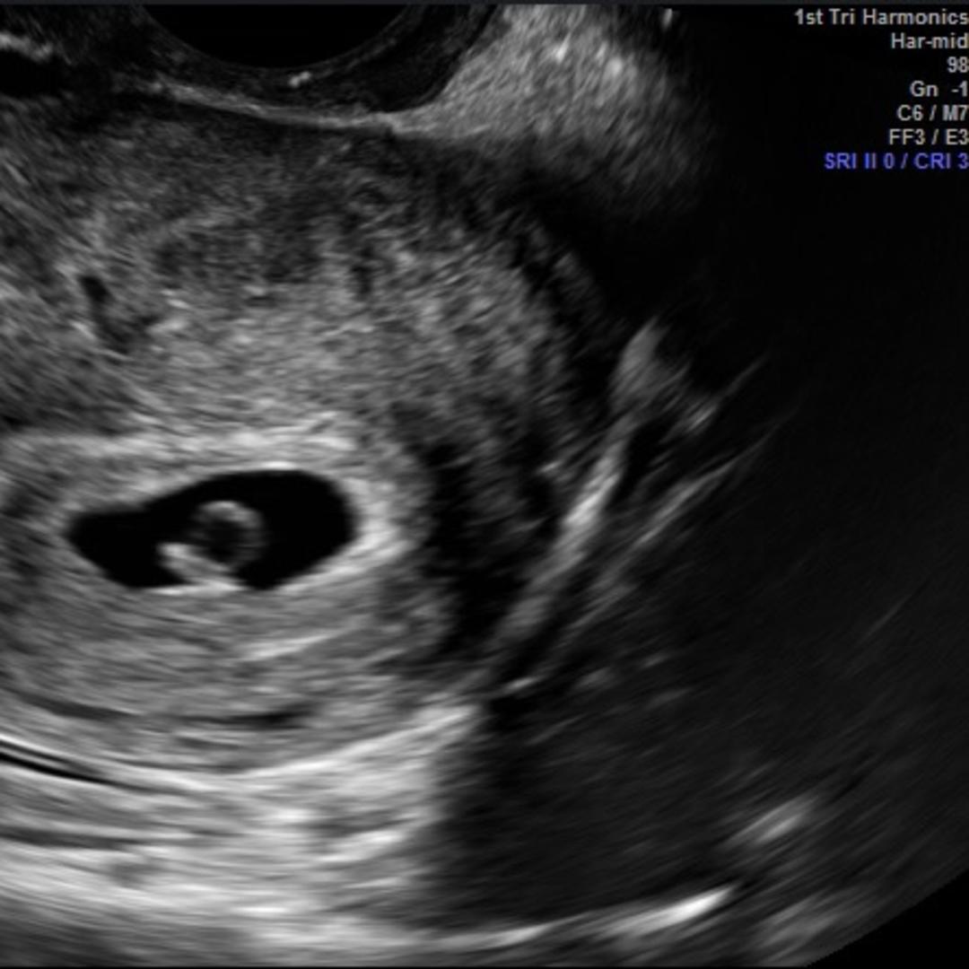 Photo shared by Daniel for their Babylist baby registry.