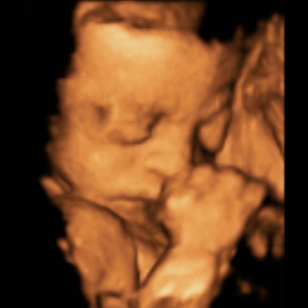 Photo shared by Abigail for their Babylist baby registry.