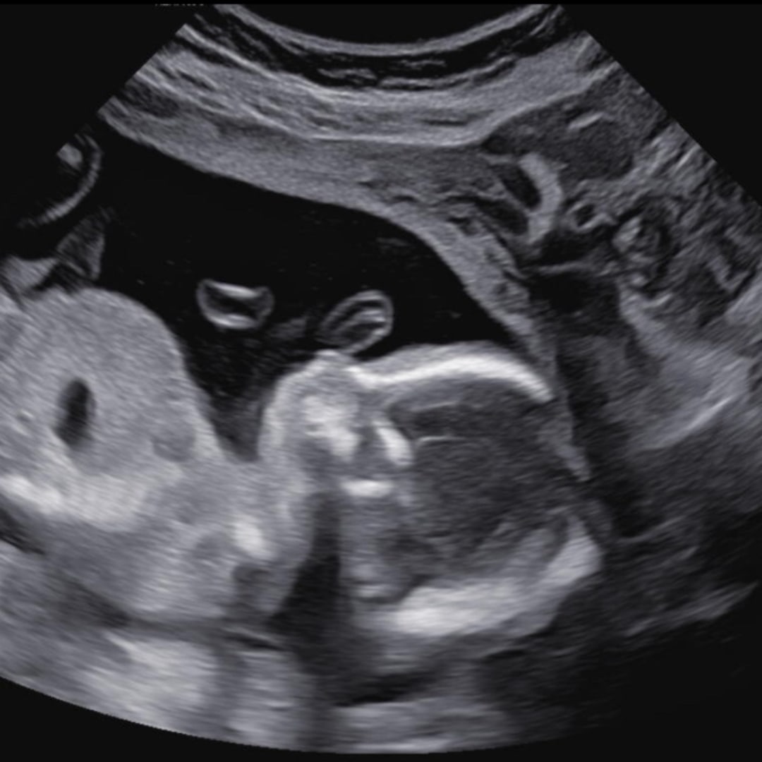 Photo shared by Carissa for their Babylist baby registry.