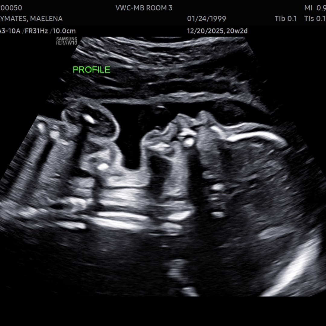 Photo shared by Danielle for their Babylist baby registry.