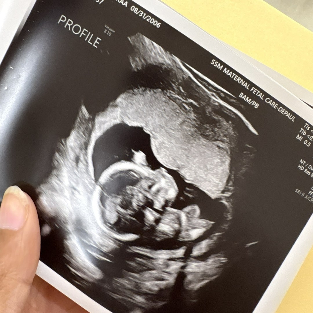 Photo shared by Noraa for their Babylist baby registry.