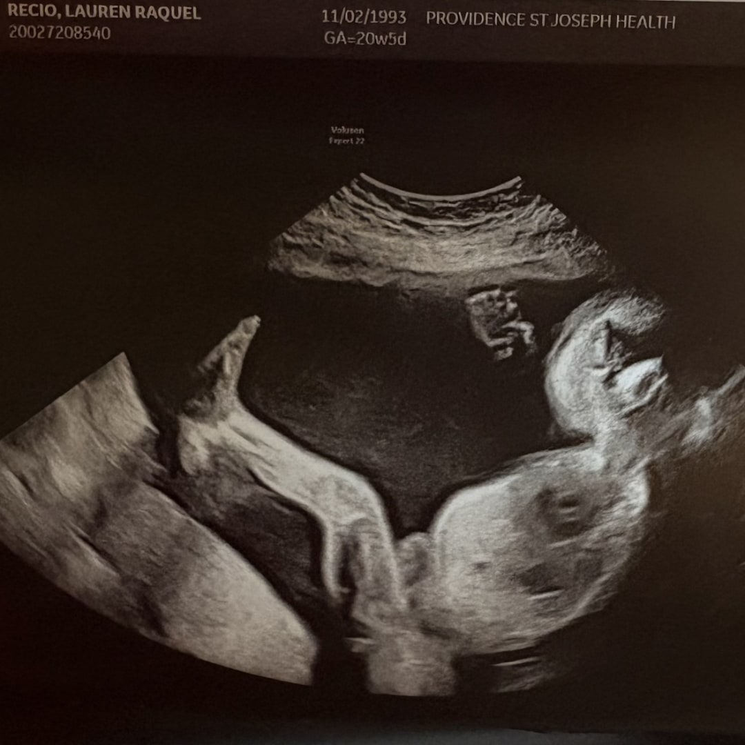 Photo shared by Lauren for their Babylist baby registry.