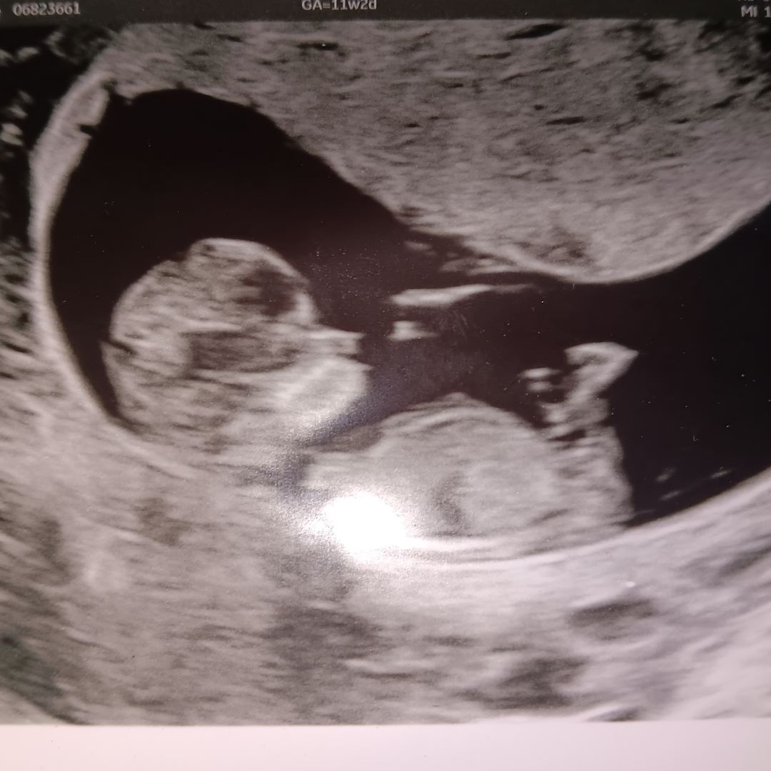 Photo shared by Jazmine for their Babylist baby registry.