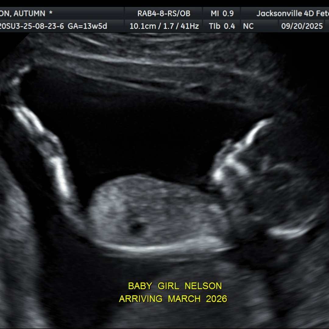 Photo shared by Autumn for their Babylist baby registry.