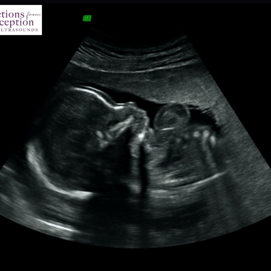 Photo shared by Jessica for their Babylist baby registry.