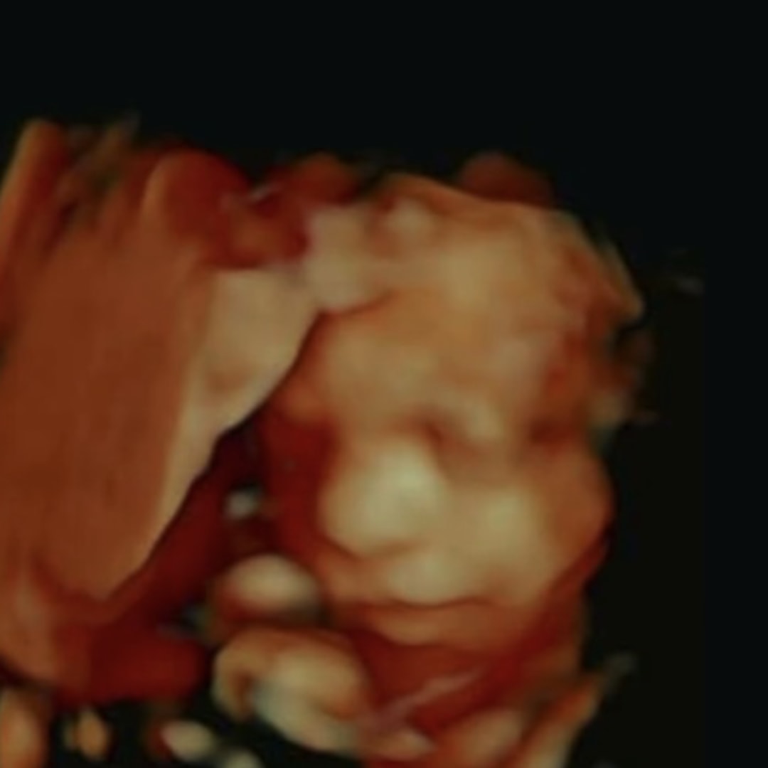 Photo shared by Amanda for their Babylist baby registry.