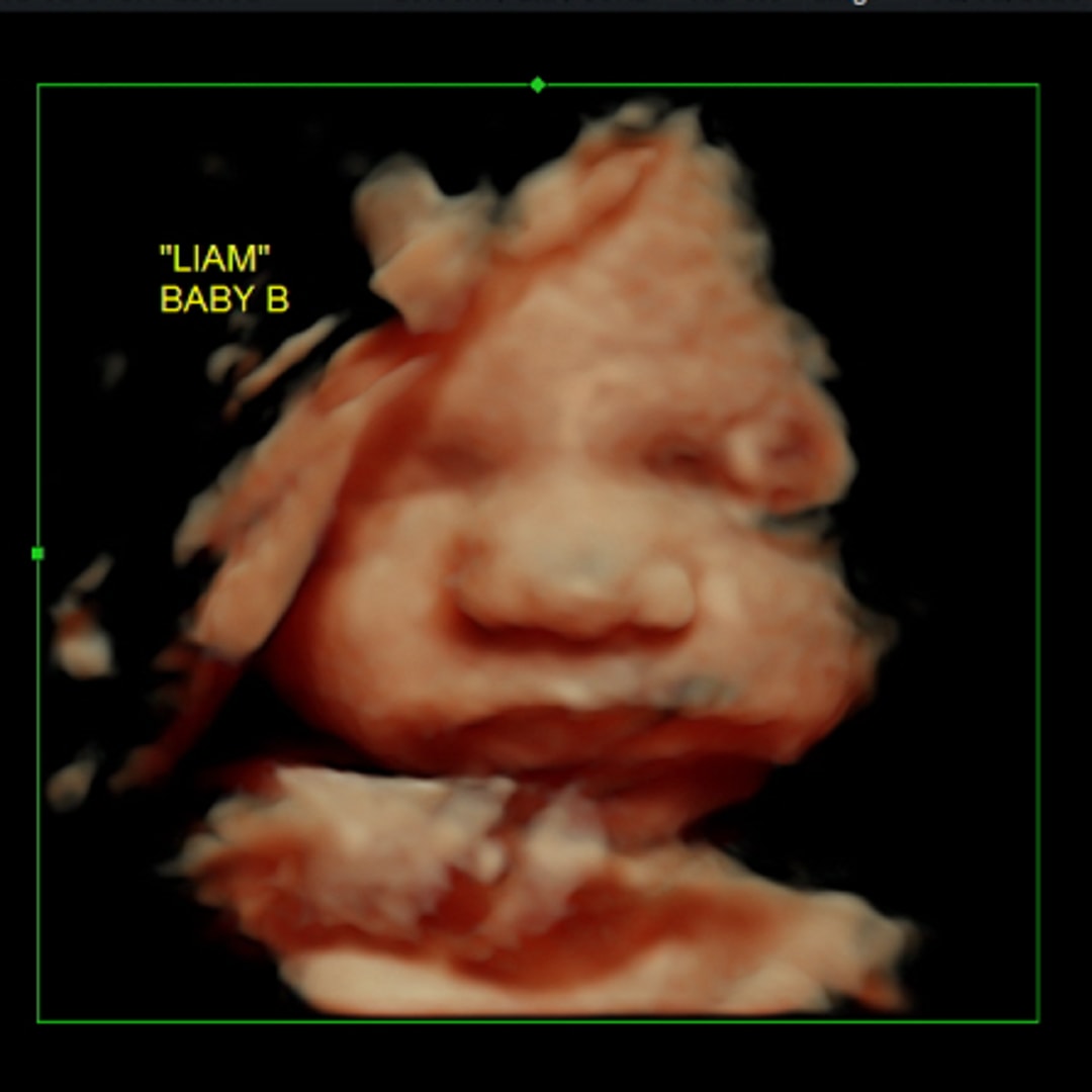 Photo shared by Macy for their Babylist baby registry.