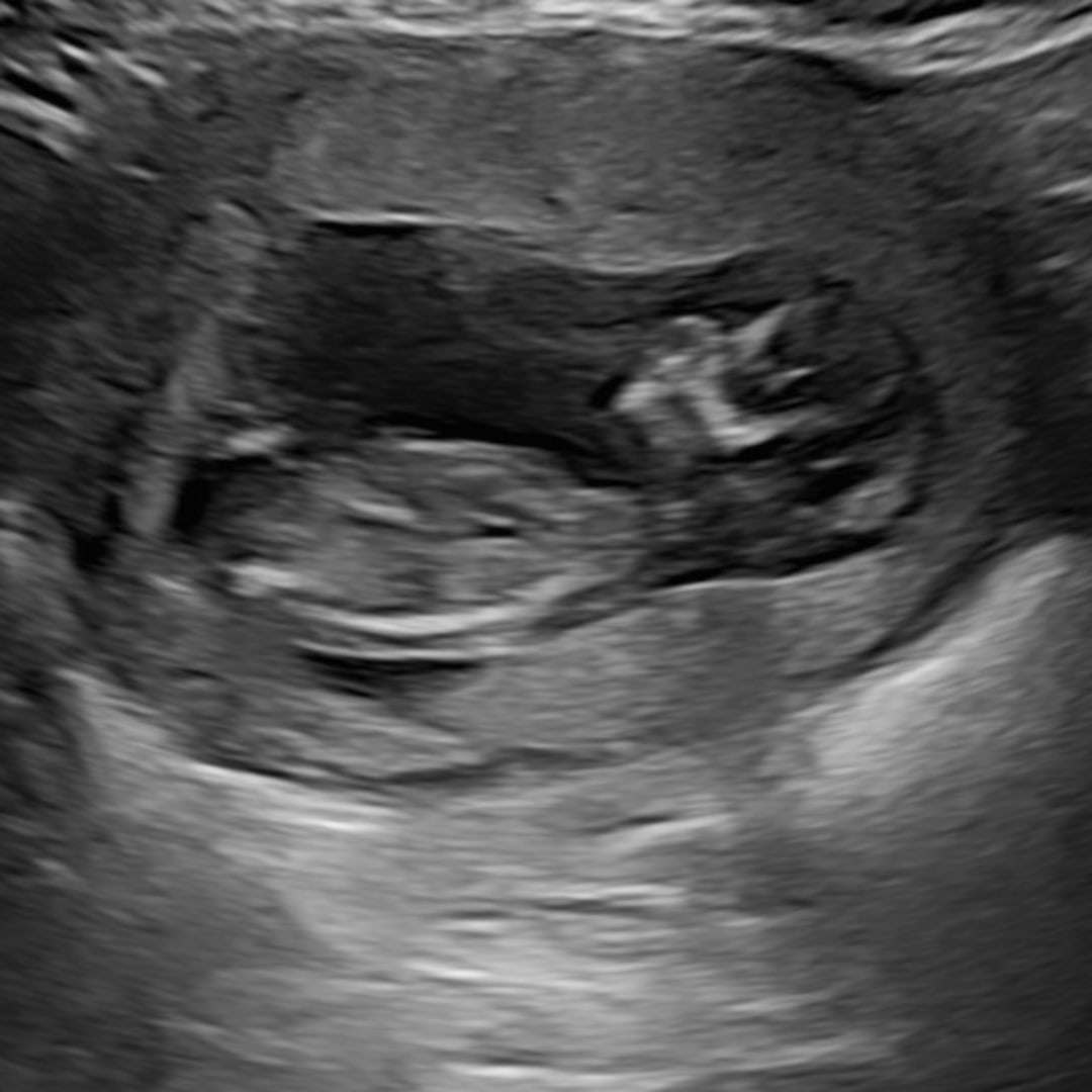 Photo shared by Samantha for their Babylist baby registry.
