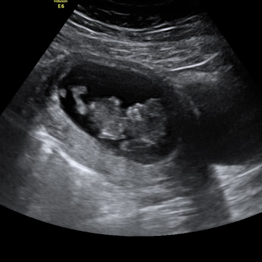 Photo shared by Brilynn for their Babylist baby registry.