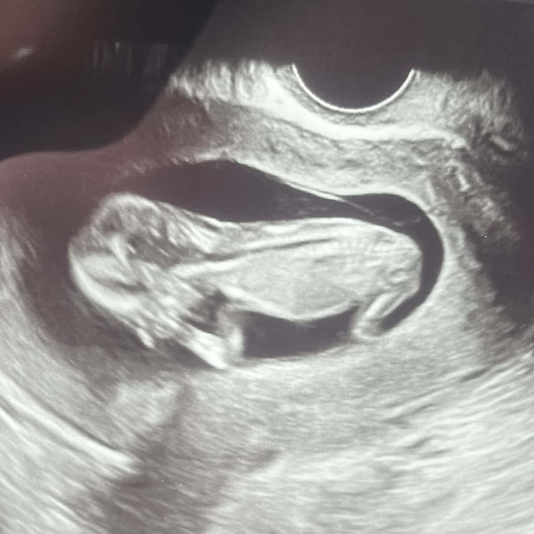 Photo shared by Cynthia for their Babylist baby registry.