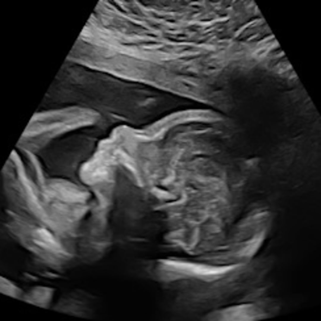 Photo shared by Lissette for their Babylist baby registry.