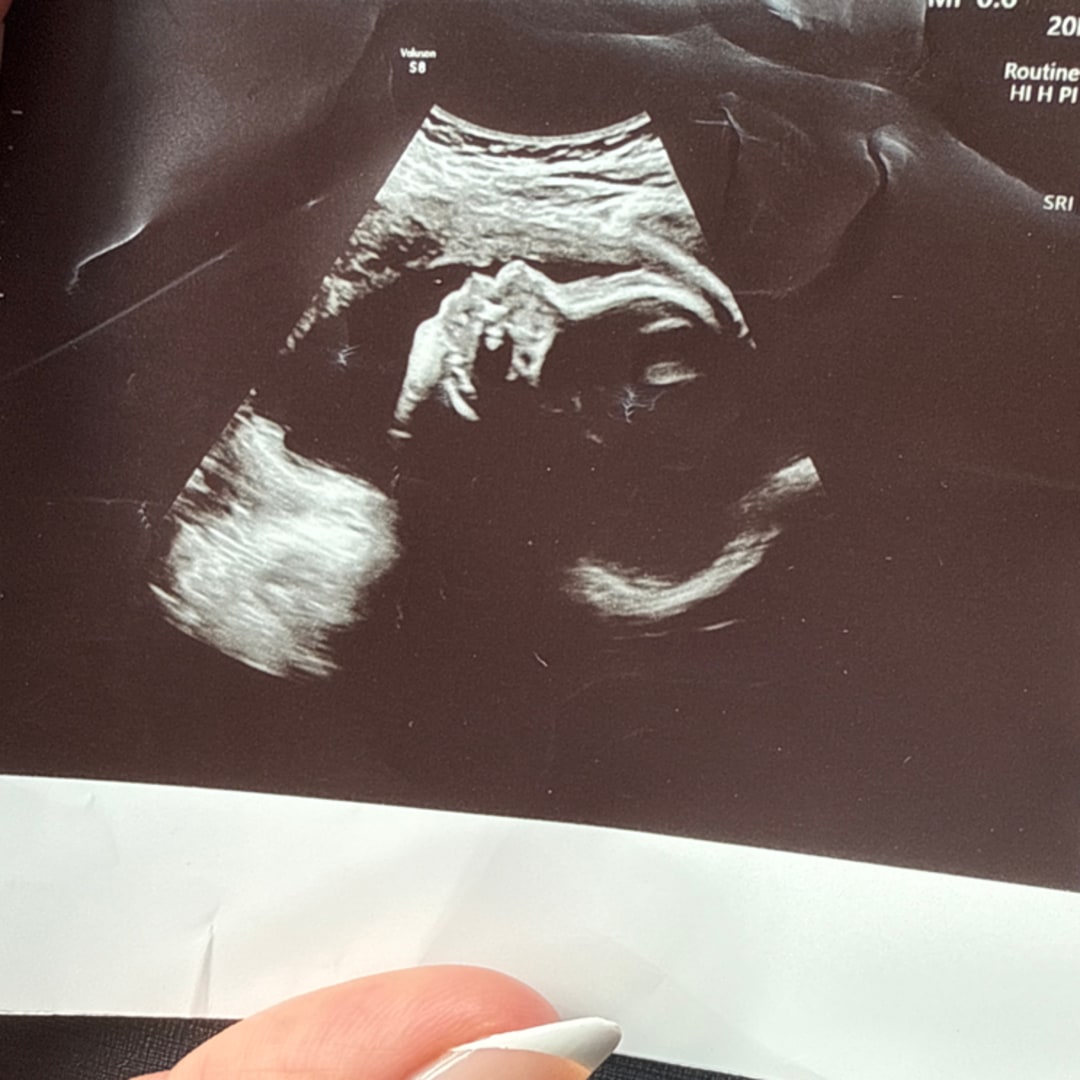 Photo shared by Brianna for their Babylist baby registry.