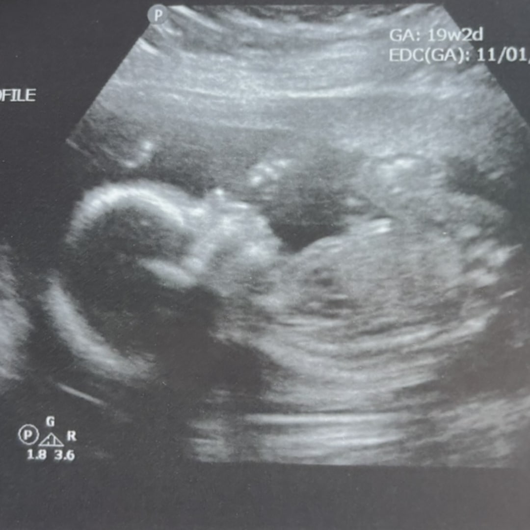 Photo shared by Abby for their Babylist baby registry.