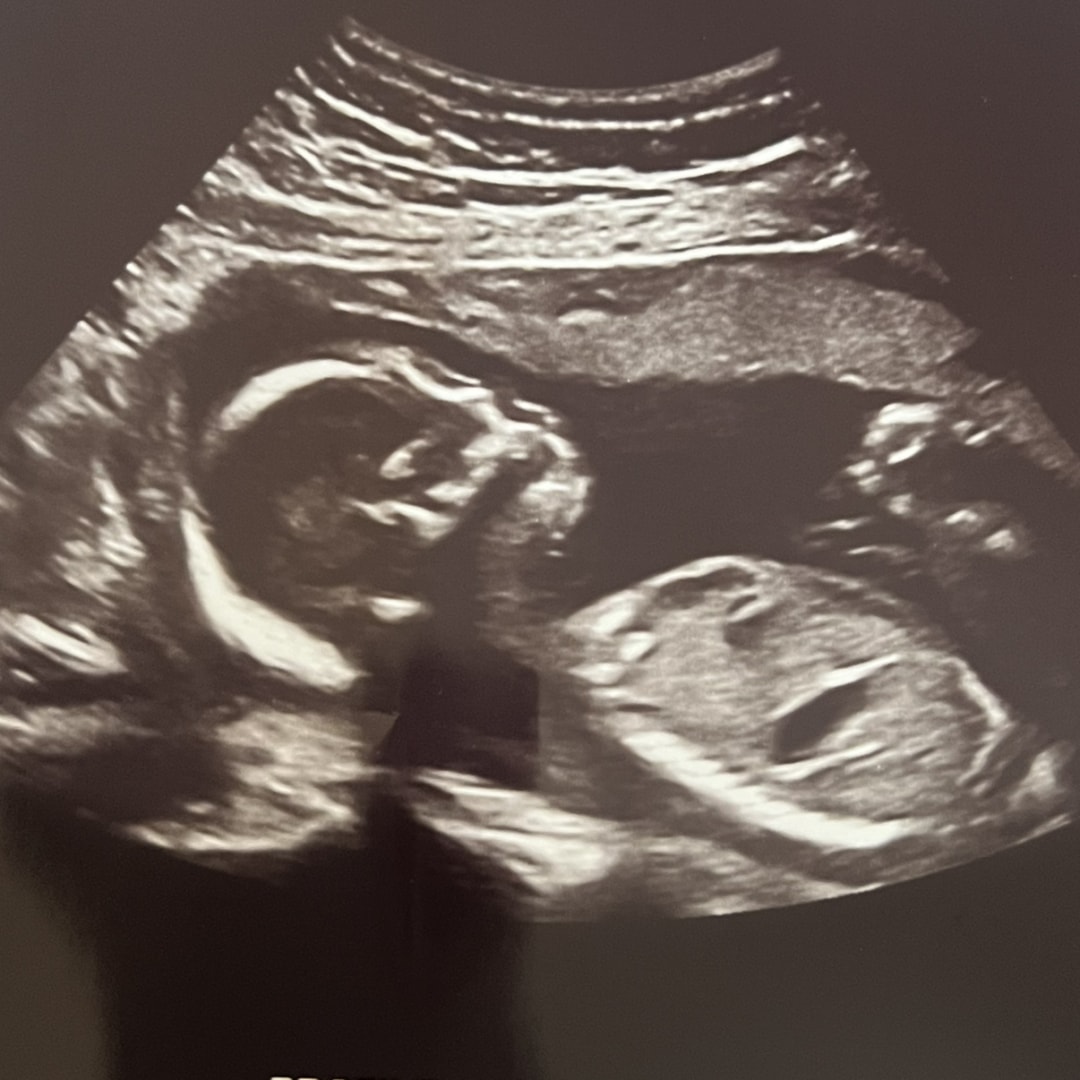 Photo shared by Raychle for their Babylist baby registry.