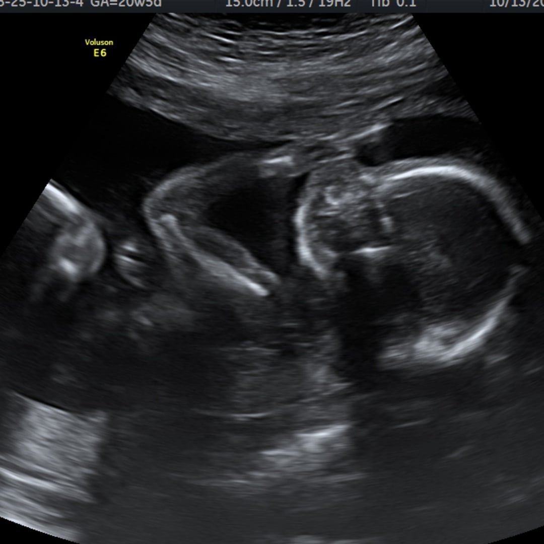 Photo shared by Michelle for their Babylist baby registry.