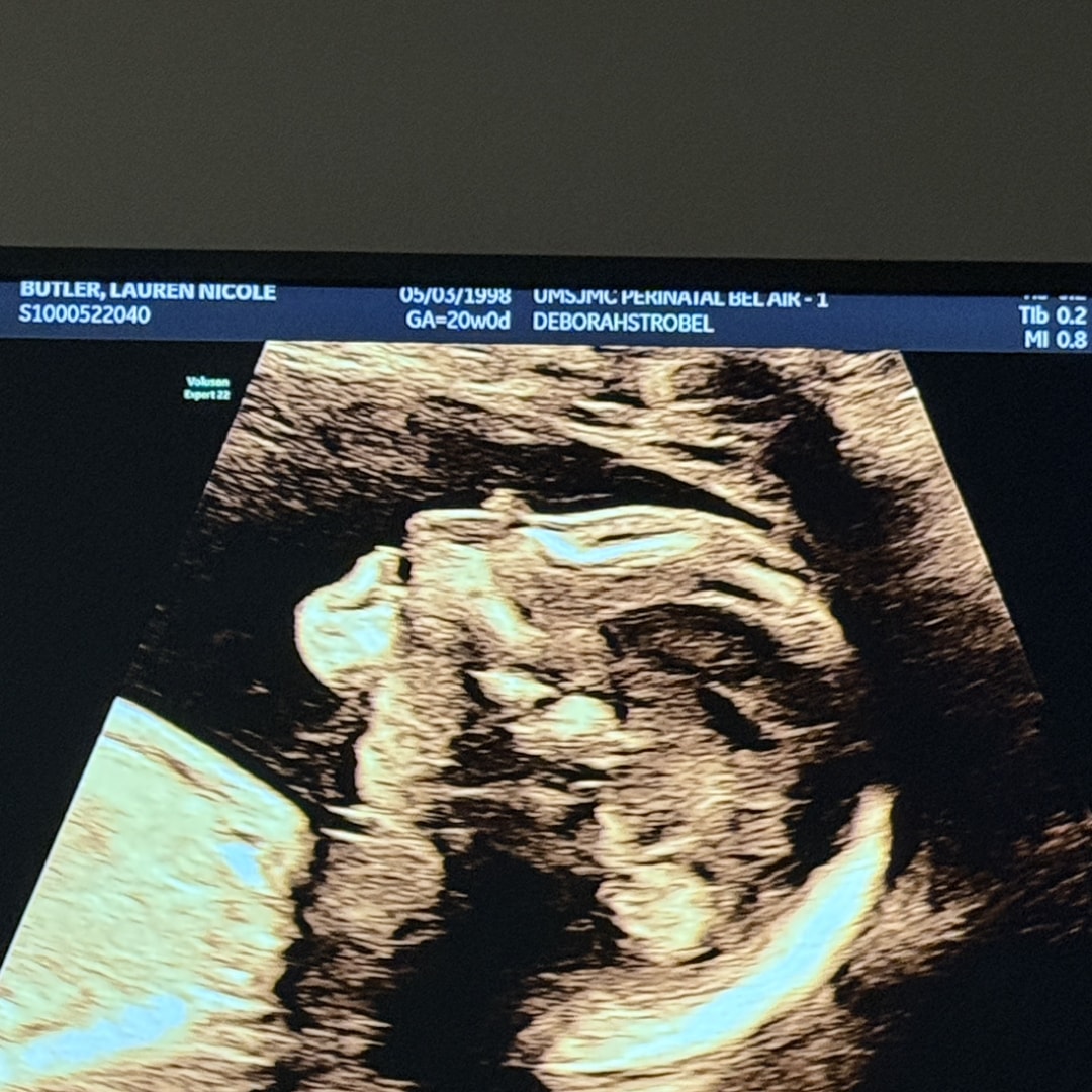 Photo shared by Lauren for their Babylist baby registry.