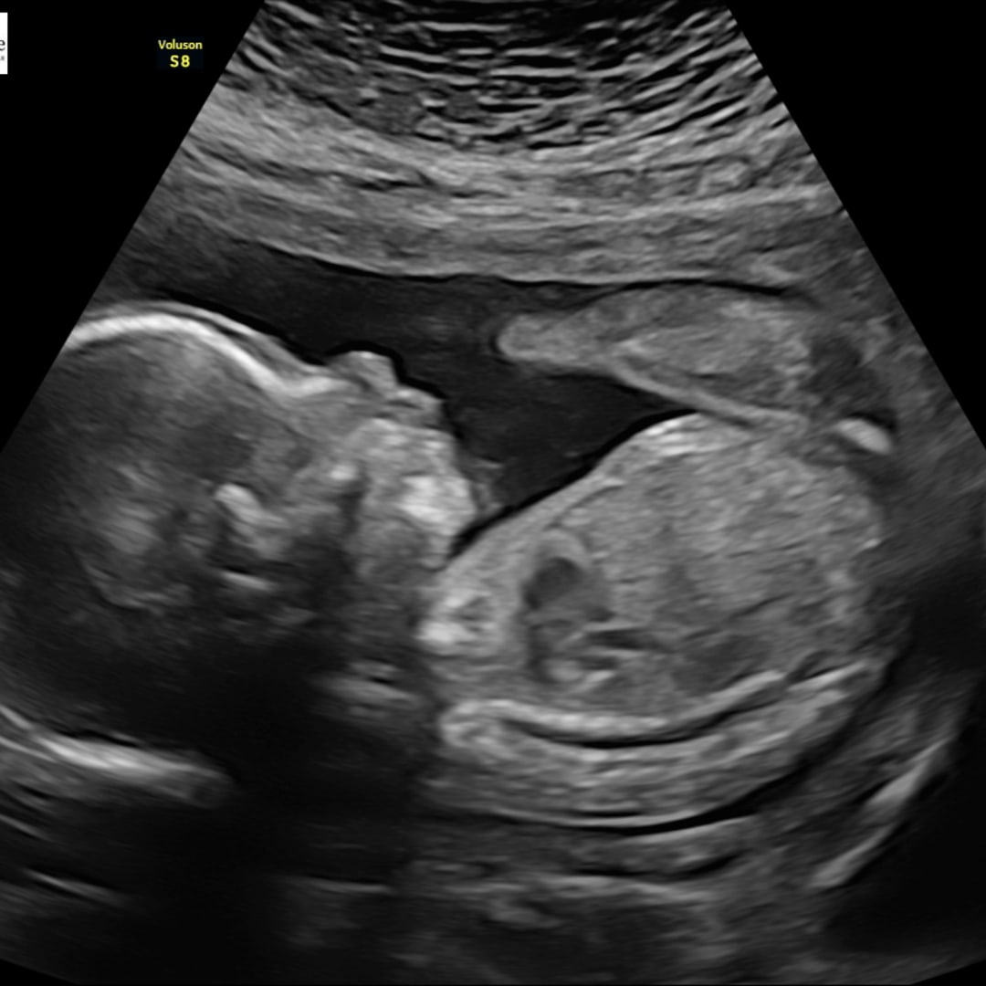 Photo shared by Tara for their Babylist baby registry.
