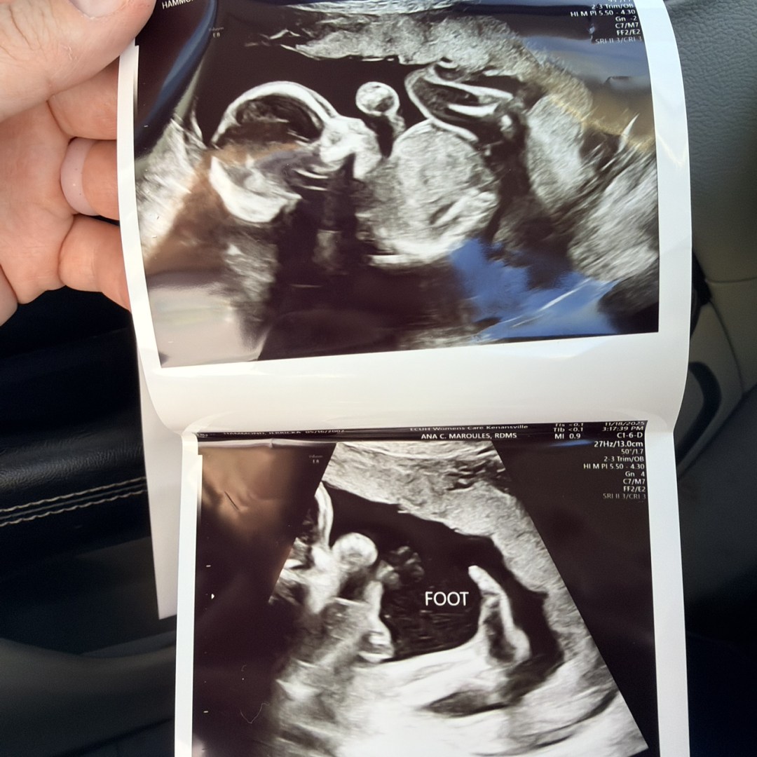 Photo shared by Jerricka for their Babylist baby registry.