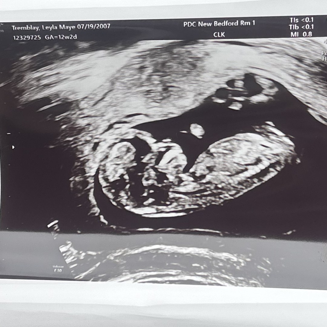 Photo shared by Leyla for their Babylist baby registry.