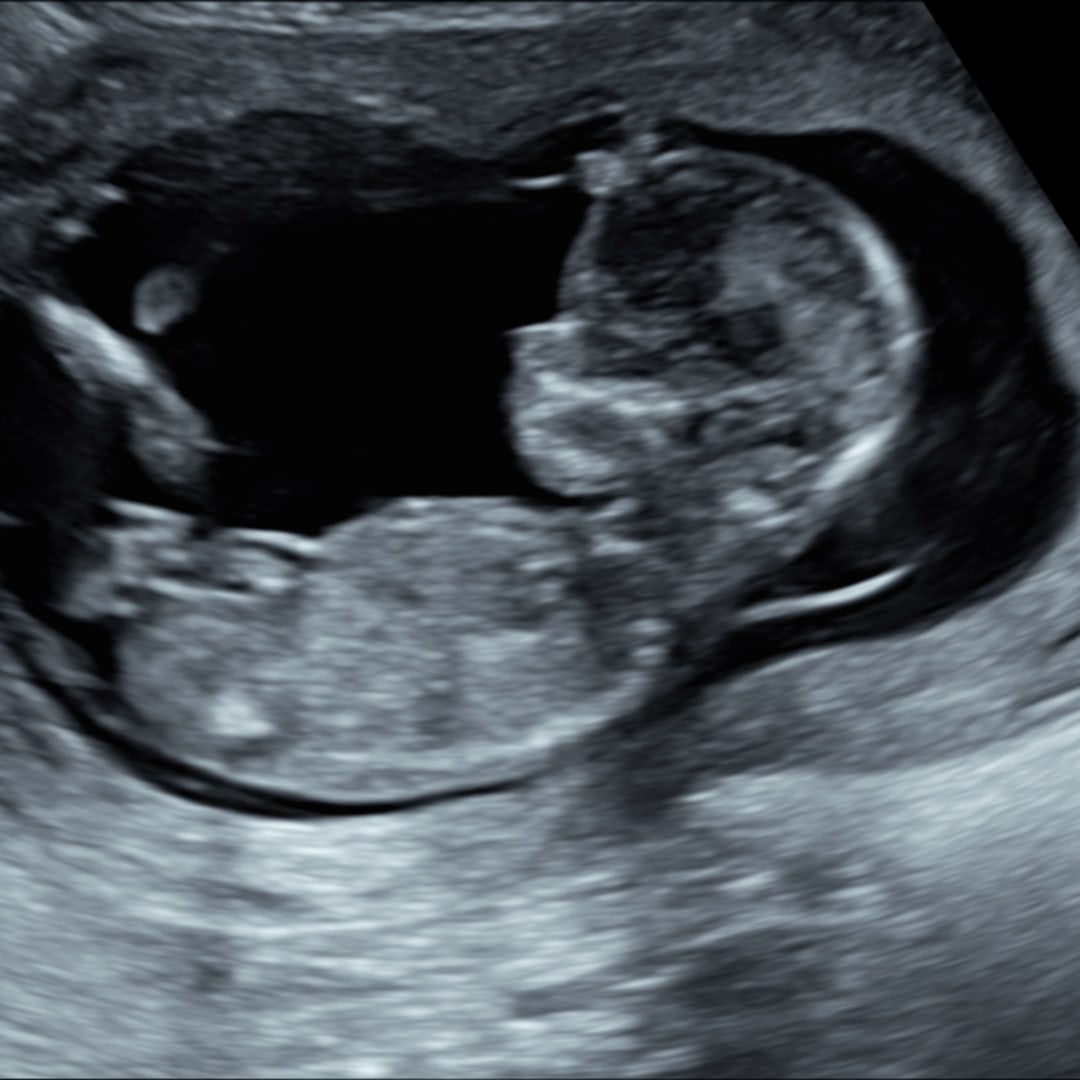 Photo shared by Melinda for their Babylist baby registry.
