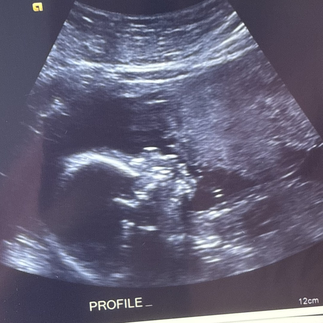 Photo shared by Brandi for their Babylist baby registry.