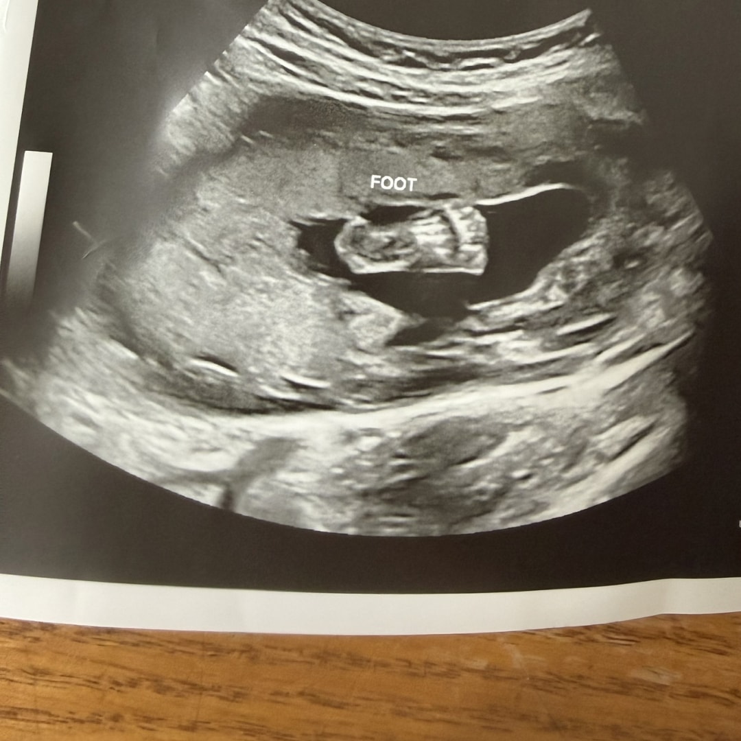 Photo shared by Zuarmy Marina for their Babylist baby registry.