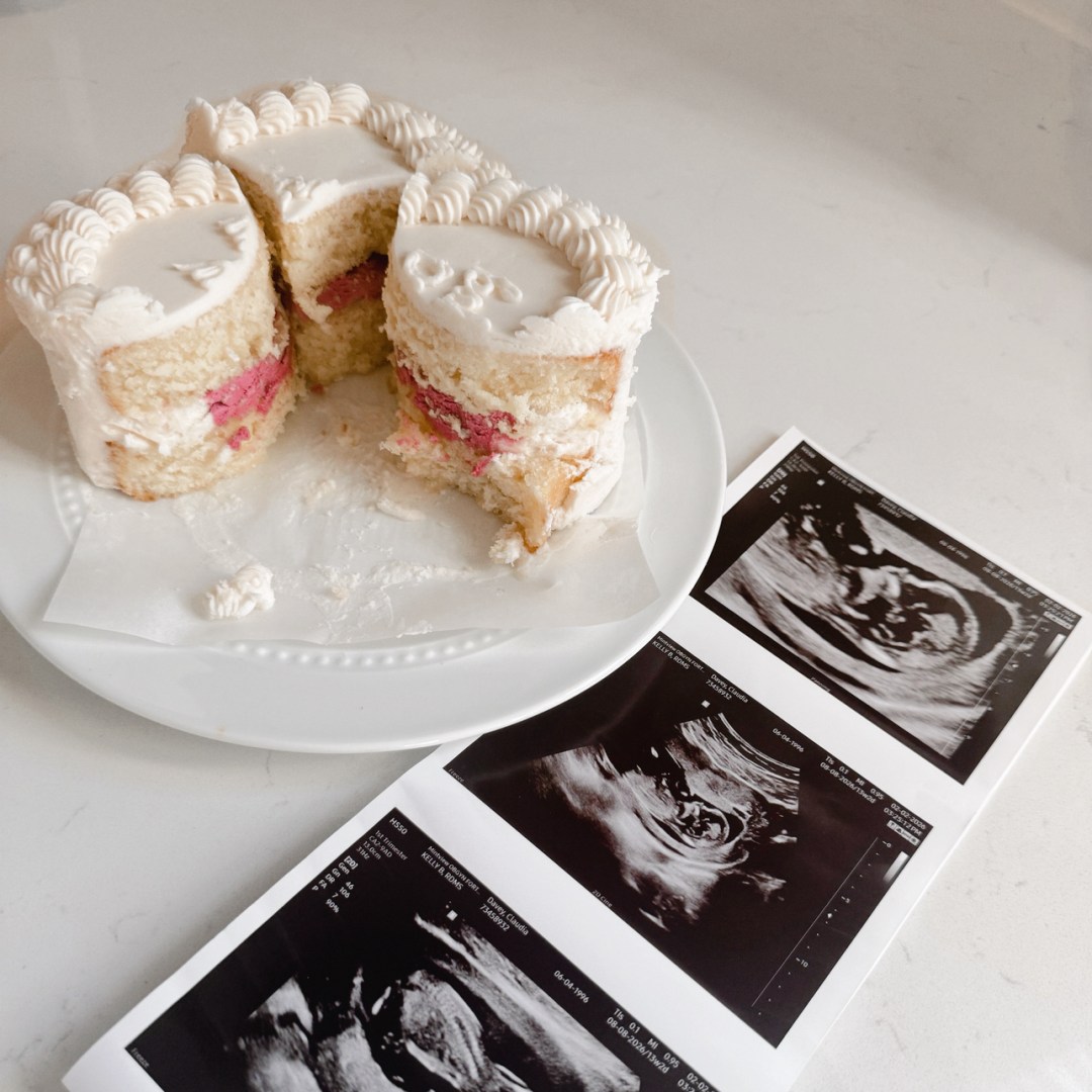 Photo shared by Claudia for their Babylist baby registry.