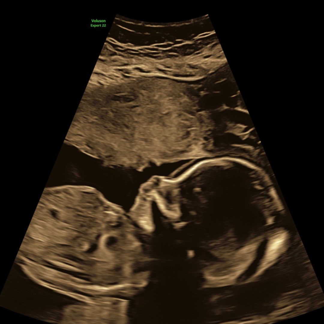 Photo shared by Melissa for their Babylist baby registry.