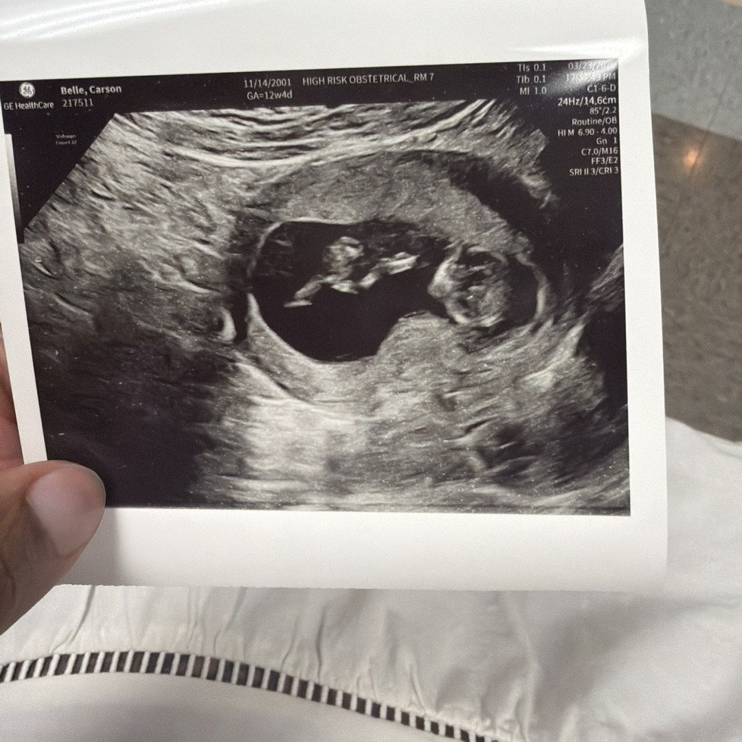 Photo shared by Carson for their Babylist baby registry.