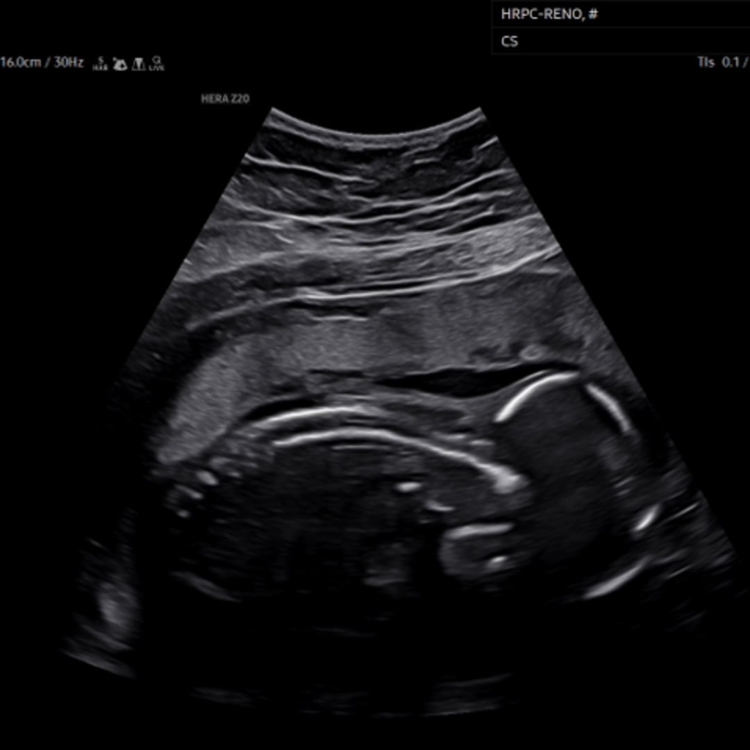 Photo shared by Lexi for their Babylist baby registry.