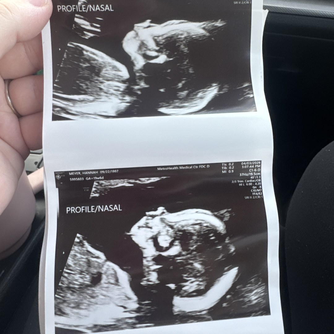 Photo shared by Hannah for their Babylist baby registry.