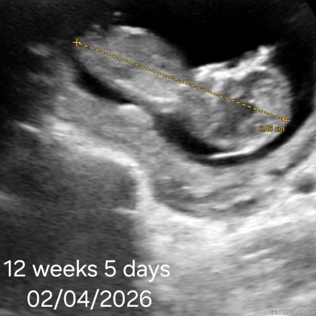 Photo shared by Chasity for their Babylist baby registry.