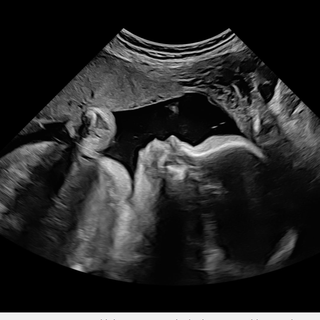 Photo shared by Kelli for their Babylist baby registry.