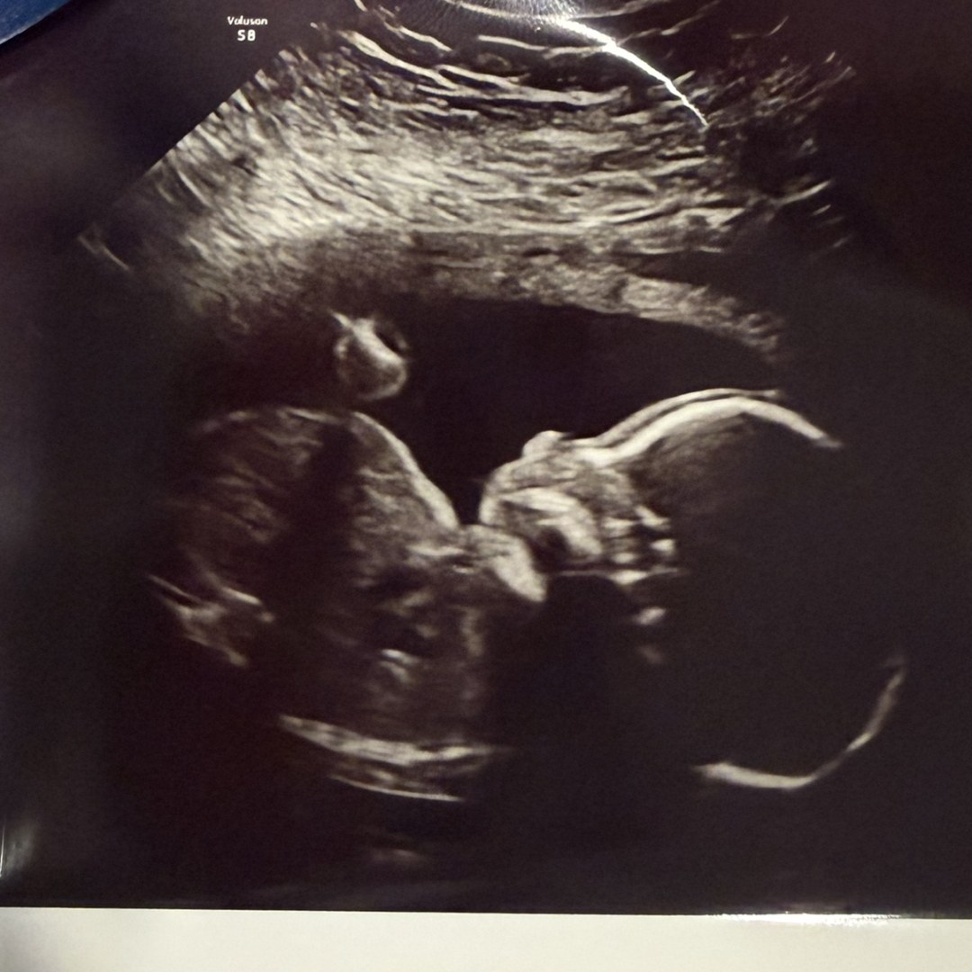 Photo shared by Sable for their Babylist baby registry.