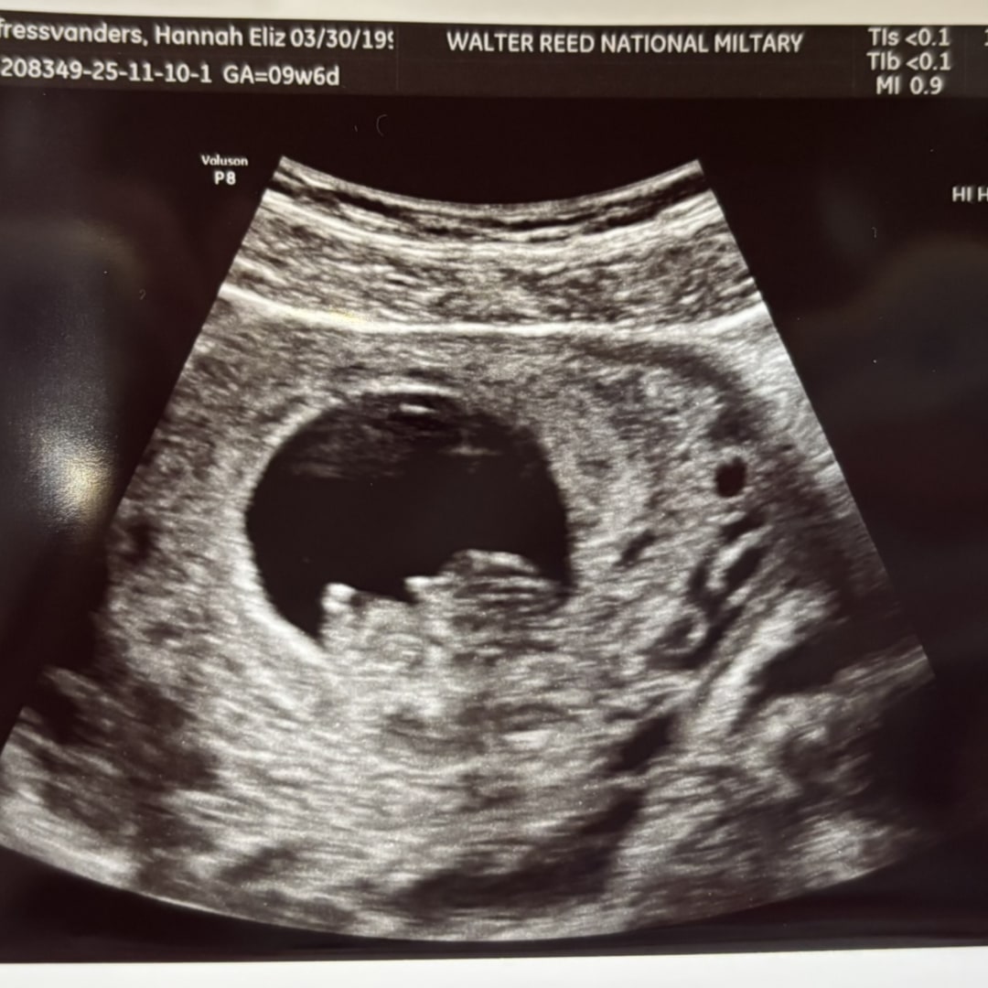 Photo shared by Hannah for their Babylist baby registry.