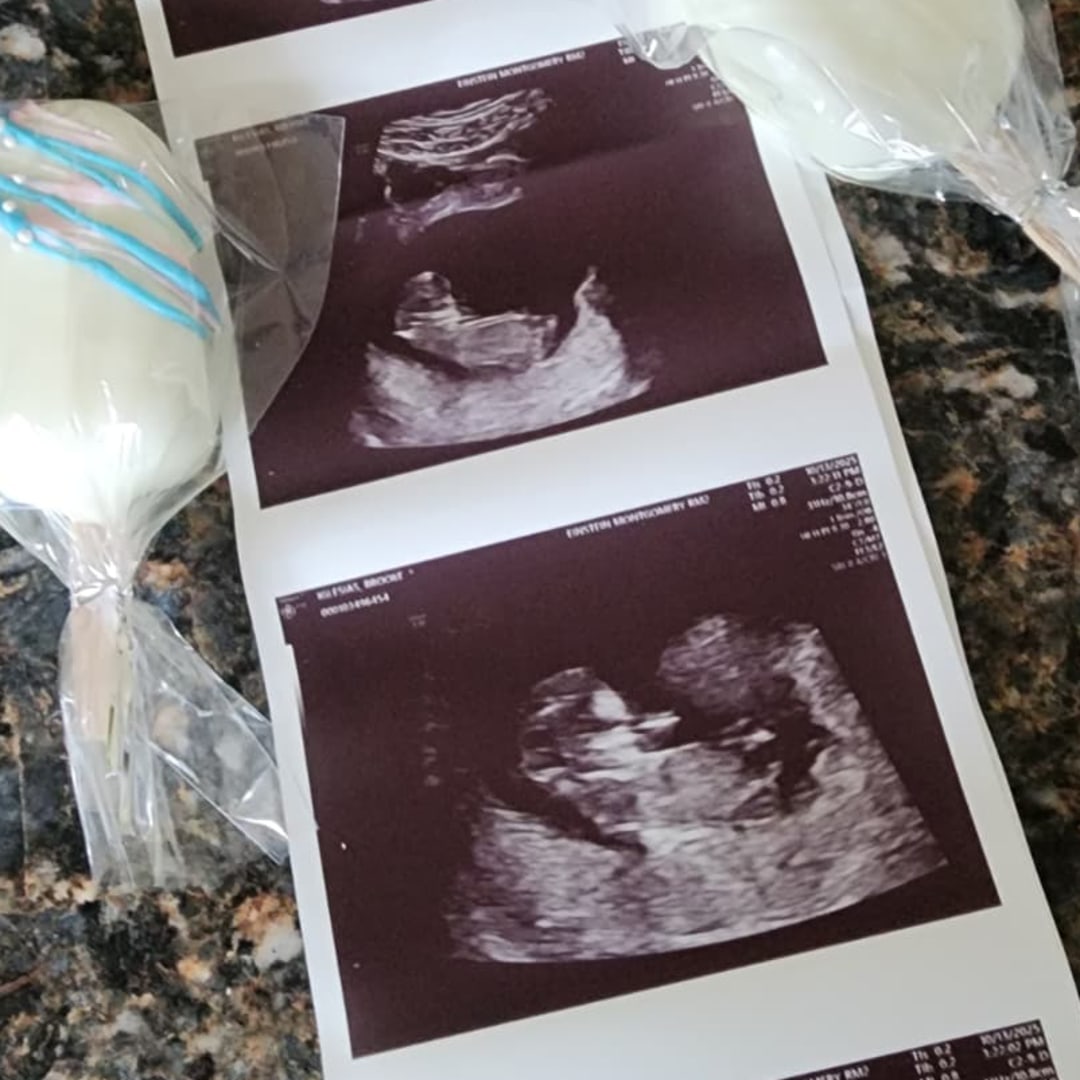 Photo shared by Brooke for their Babylist baby registry.