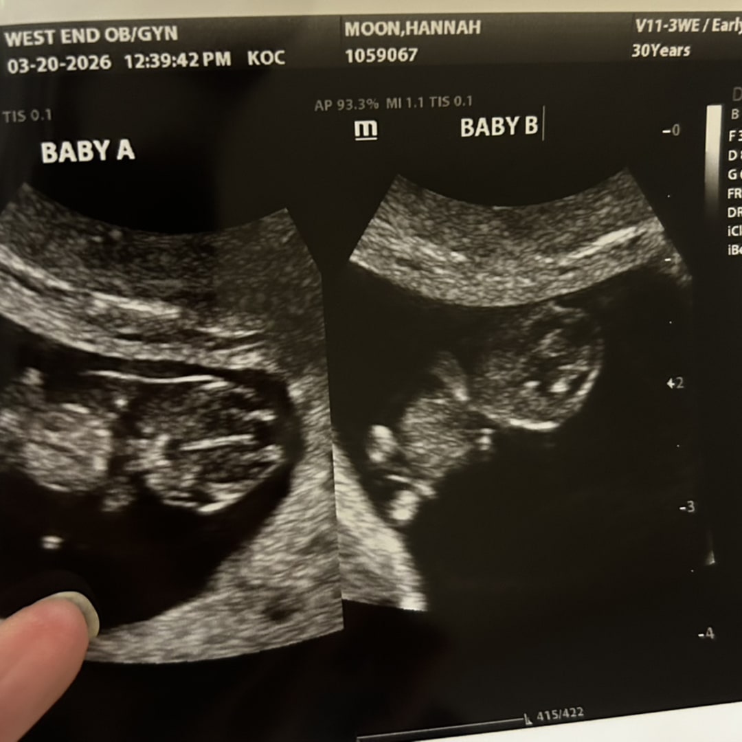 Photo shared by Hannah for their Babylist baby registry.