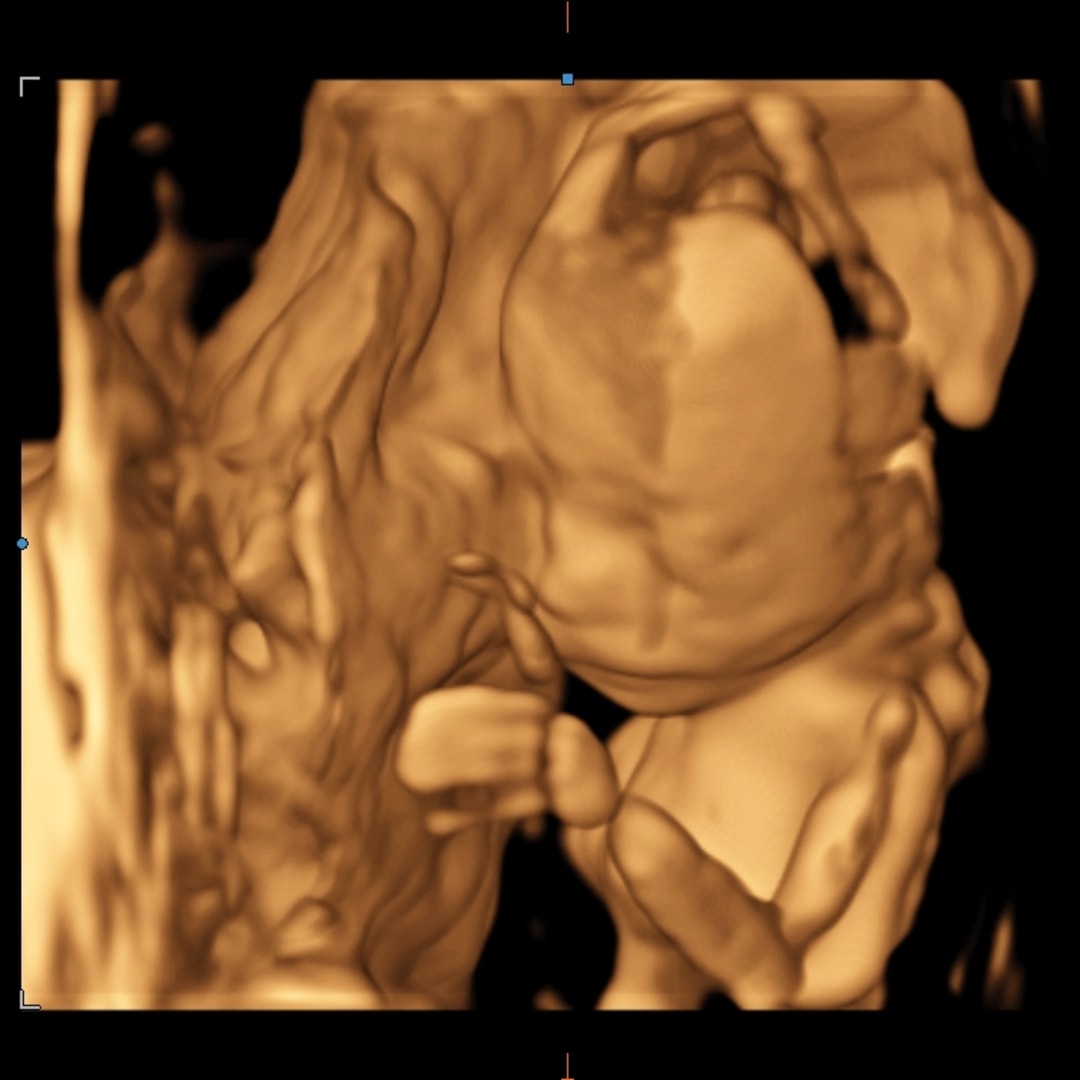 Photo shared by Amber for their Babylist baby registry.