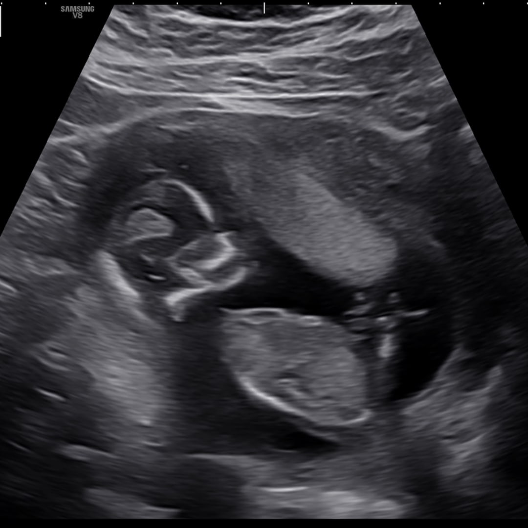 Photo shared by Kelsey for their Babylist baby registry.